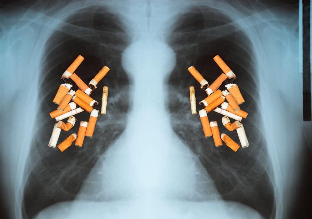 Kako cigarete utječu na pluća